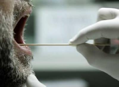 Extraccion_saliva Extraccion_saliva
