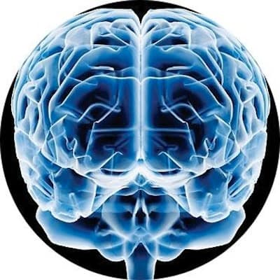 cerebro